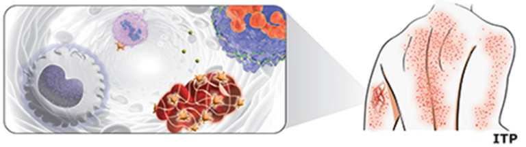 New pathway in immune defense discovered